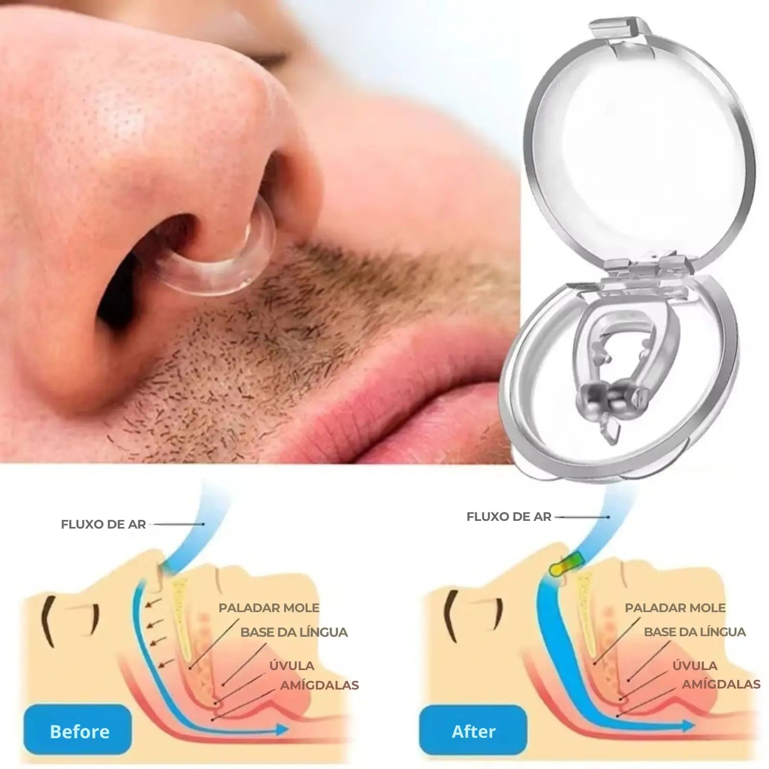 Clipe Nasal Anti Ronco de Silicone para Respiração Mais Livre